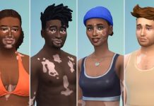 The Sims 4 Vitiligo